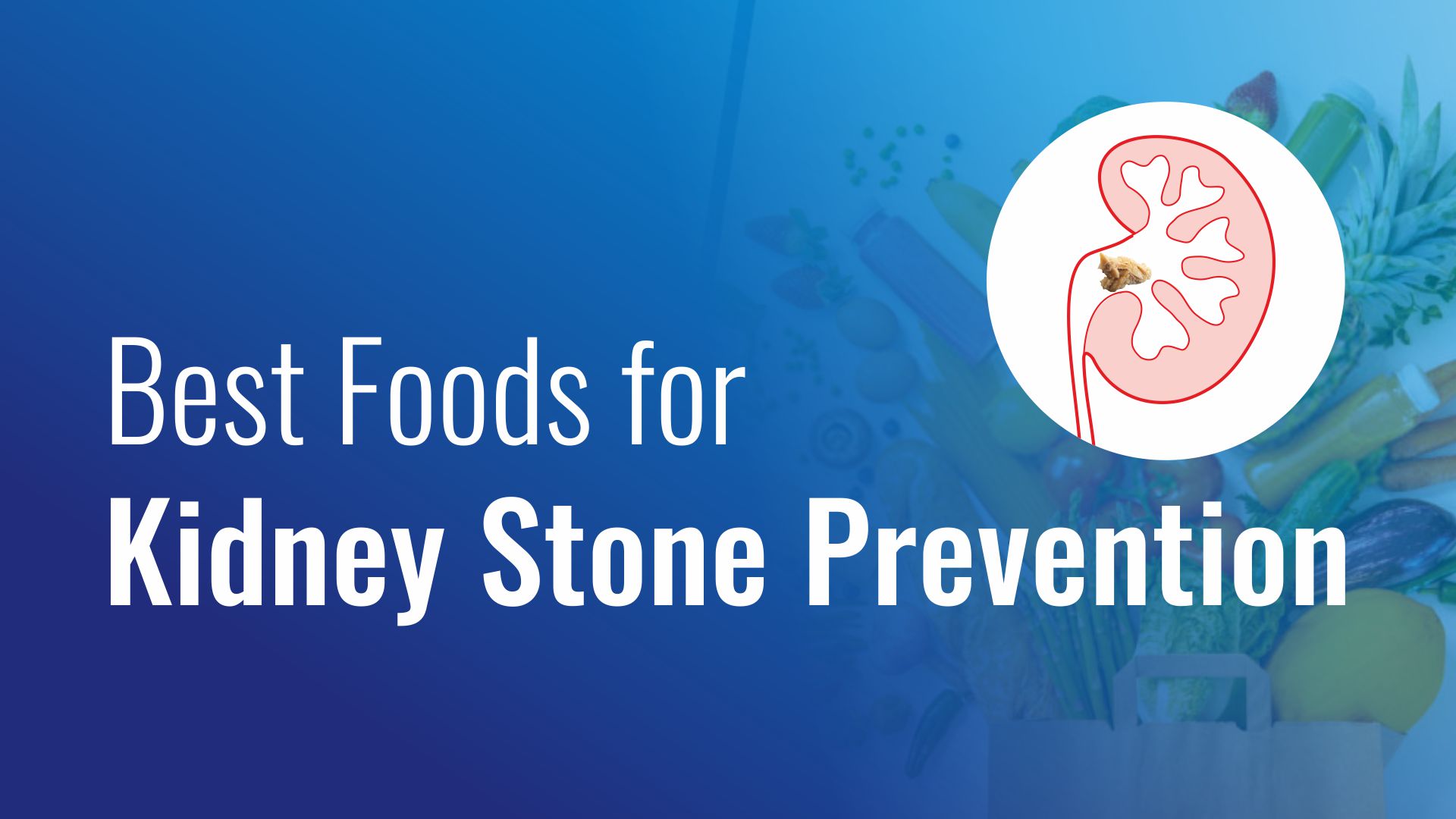 Best Foods for Kidney Stone Prevention