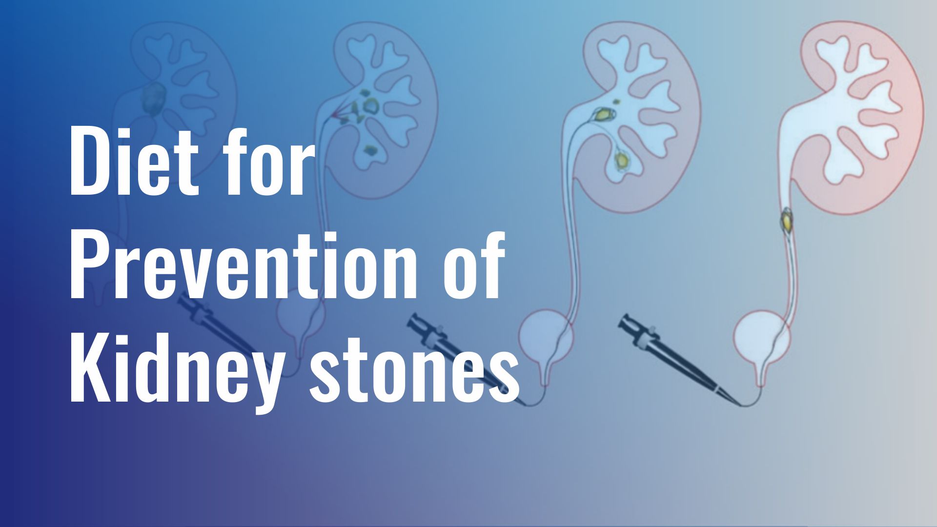 Diet for prevention of Kidney stones