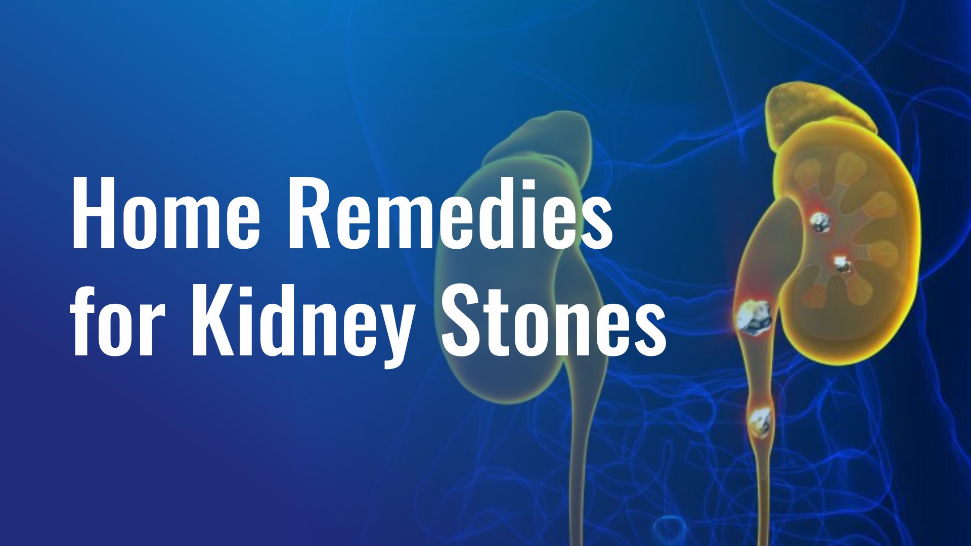 Home Remedies for Kidney Stones