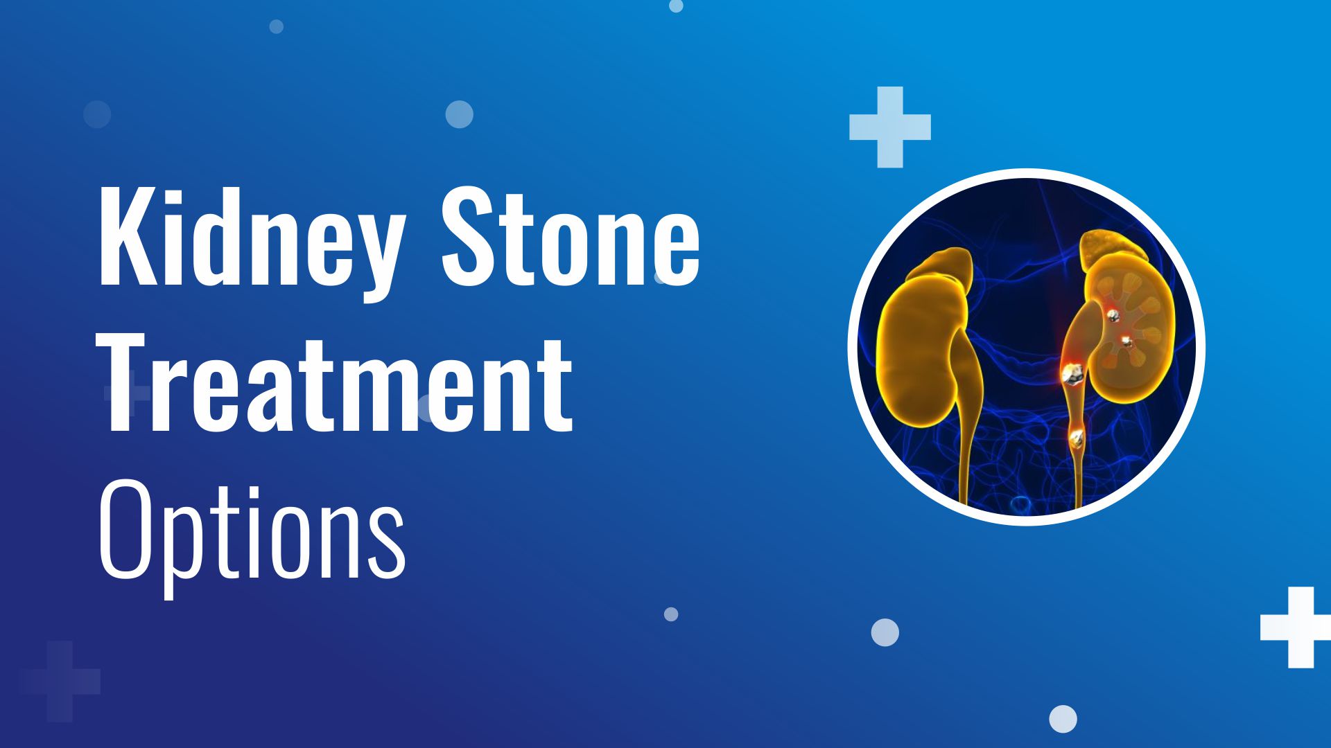 Kidney Stone Treatment Options