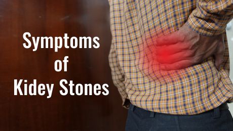 Symptoms of Kidney Stones