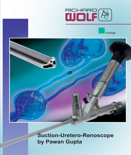 Ureteroscope Designed by Dr. Pawan Gupta