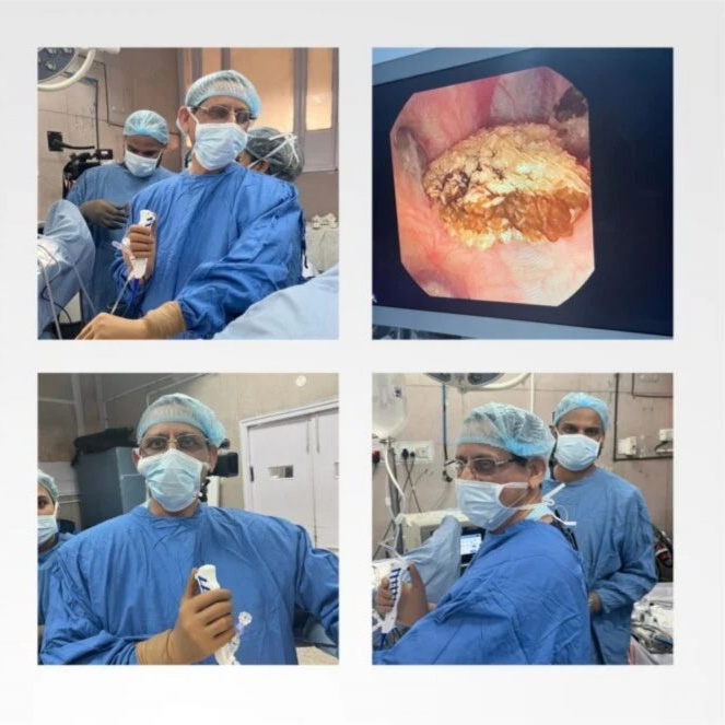 dr pawan gupta demonstrating rirs in pgi chandigarh